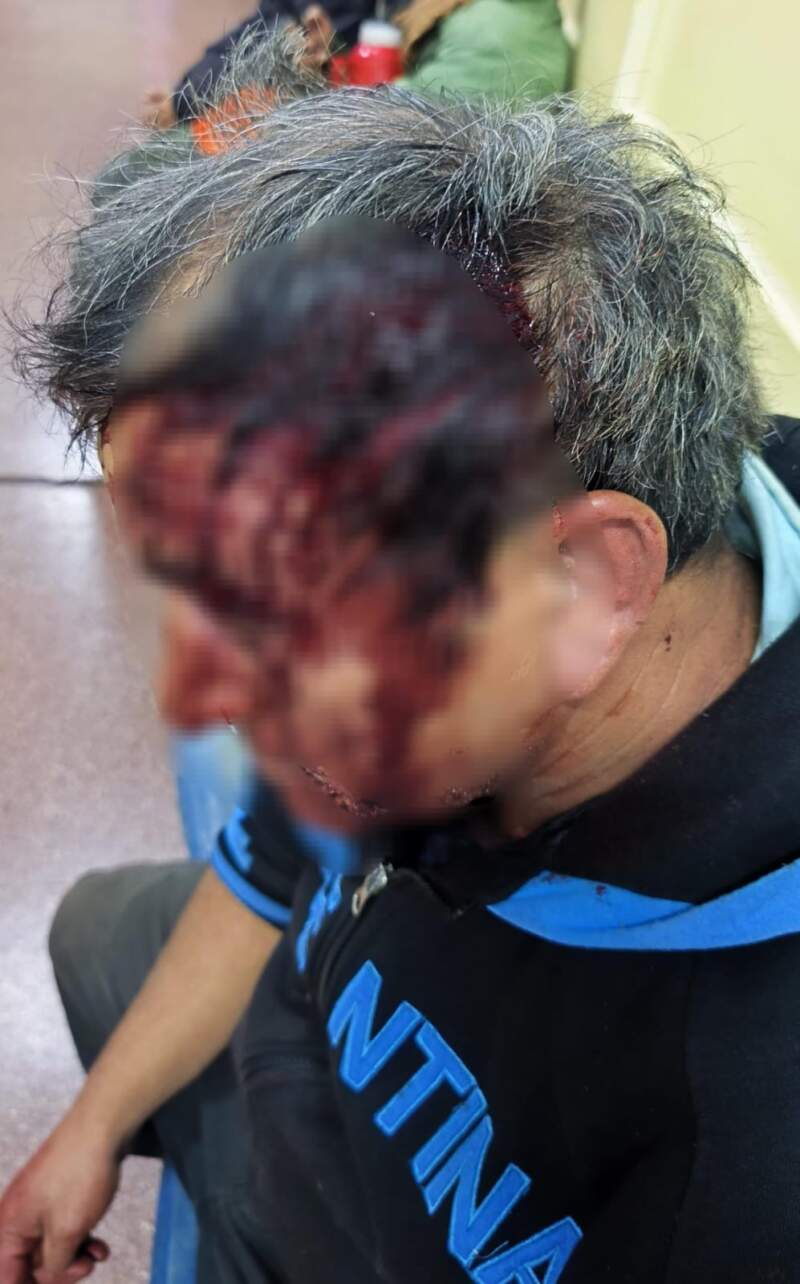Detuvieron a los dos acusados de agredir con un palo a un vecino en Posadas 2 Detuvieron a los dos acusados de agredir con un palo a un vecino en Posadas imagen-1