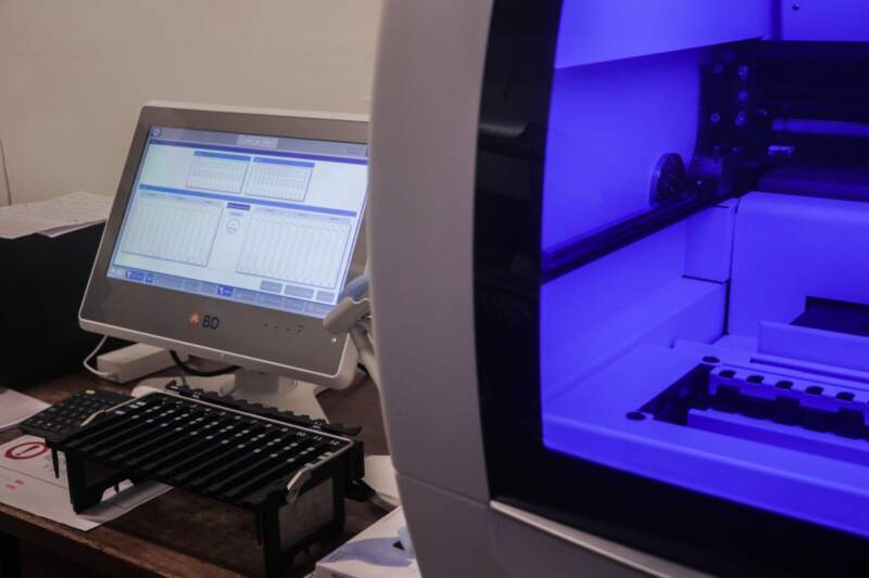 Diagnósticos en menos de dos horas: el Parque de la Salud incorpora nueva tecnología para detectar tuberculosis y virus respiratorios imagen-6