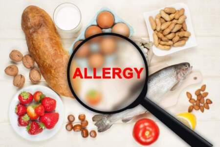 Semana Mundial de la Alergia Alimentaria: impulsan la prevención y el diagnóstico temprano para evitar complicaciones graves imagen-10
