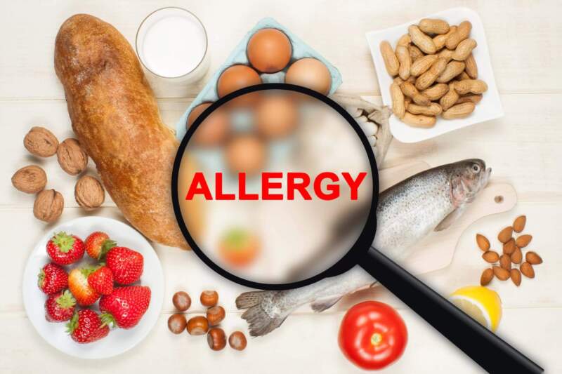 Semana Mundial de la Alergia Alimentaria: impulsan la prevención y el diagnóstico temprano para evitar complicaciones graves imagen-8